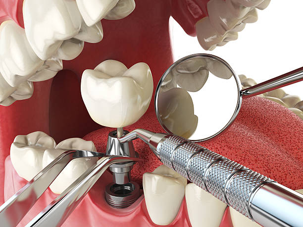 Best Cosmetic Emergency Dentistry in Lawson, MO